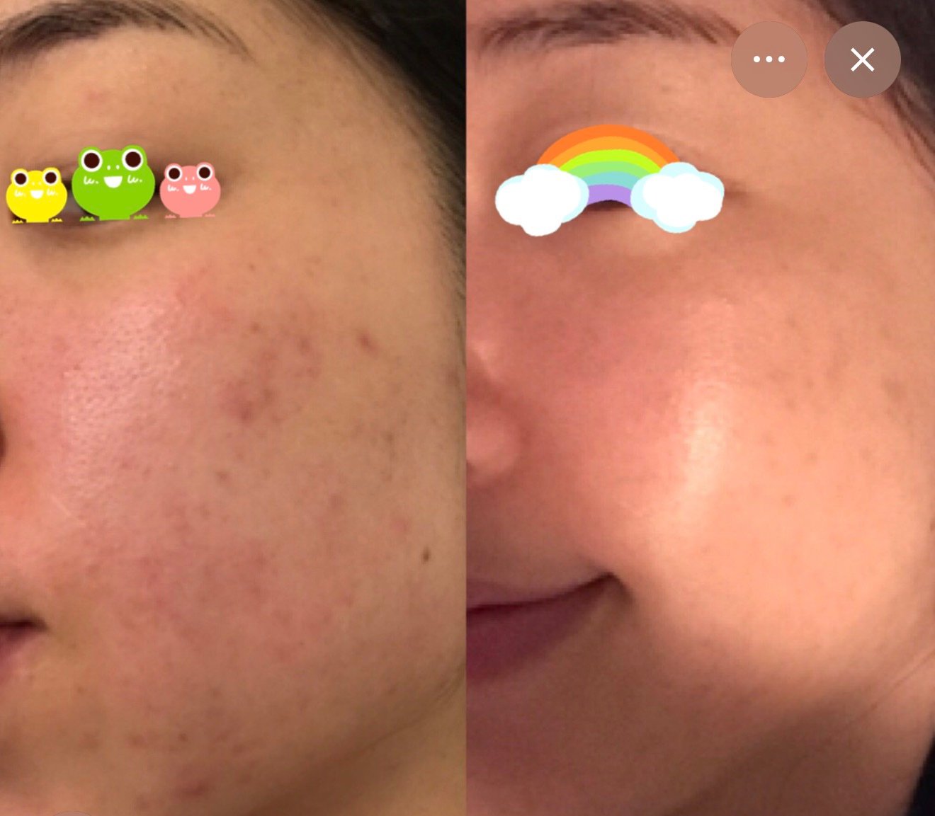 Facial transformation — before and after